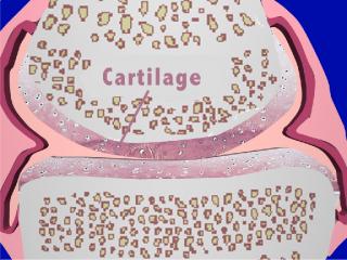 cartilage.jpg (20164 bytes)