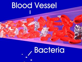 Copy of inflammation FirstLabeled.jpg (16321 bytes)