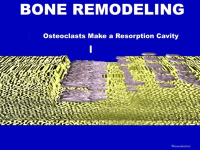 Cartilage and Bone Matrix Remodeling, Osteoblasts,  Osteoclasts:Slides,Images and Animations in Arthritis and Rheumatism page 14