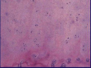 4cartilage abnl2.jpg (10345 bytes)
