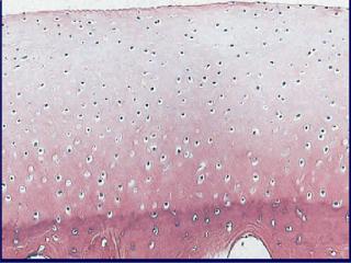 4cartilage histo.jpg (15941 bytes)