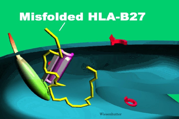 What is HLA-B27?